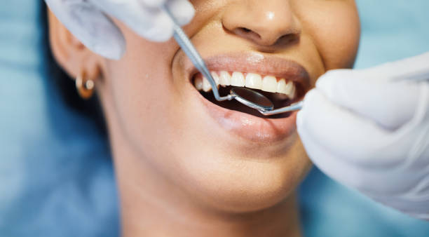 Best Emergency Root Canal Treatment in Crescent City, FL
